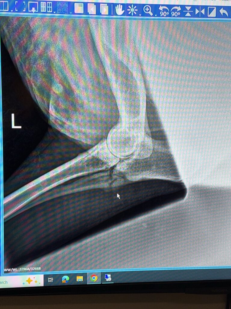 annie x-ray